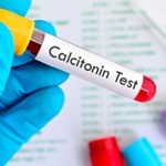 What causes high calcitonin levels