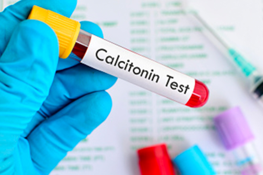 What causes high calcitonin levels