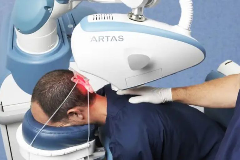 Advancements in Robotic Hair Transplantation Techniques in India