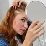 Causes and Treatments For Female Hair Loss