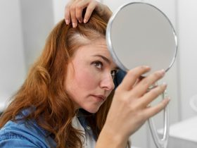 Causes and Treatments For Female Hair Loss