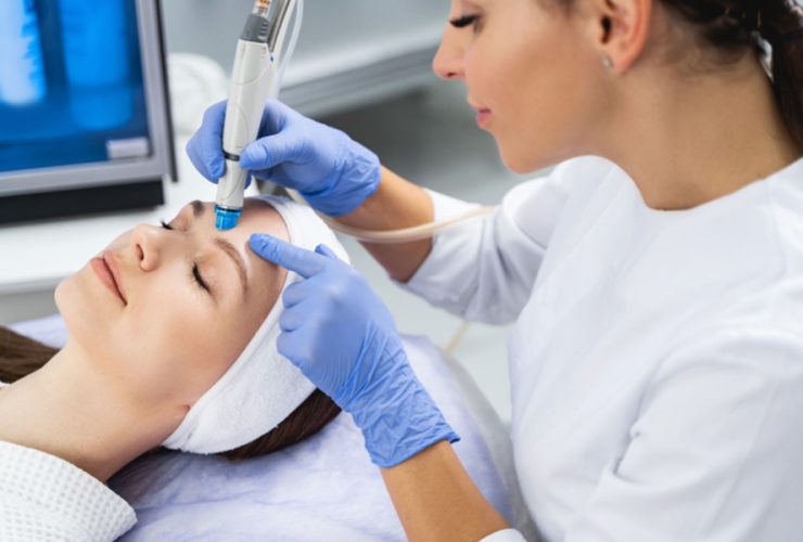 Is the Hydrafacial in Singapore Worth It for Acne Prone Skin