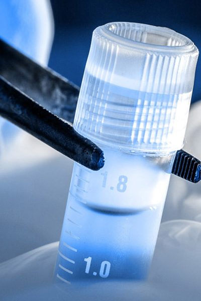 Stem Cell Banking in India StemCellCures Role in Future Healthcare Security