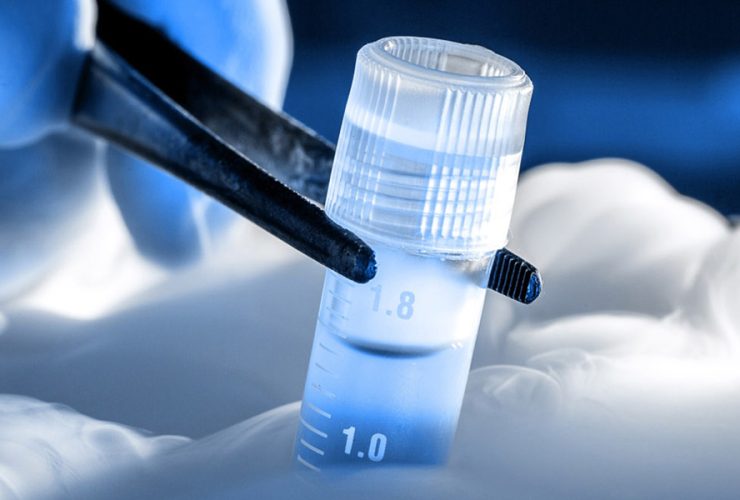 Stem Cell Banking in India StemCellCures Role in Future Healthcare Security