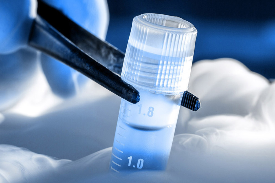 Stem Cell Banking in India StemCellCures Role in Future Healthcare Security