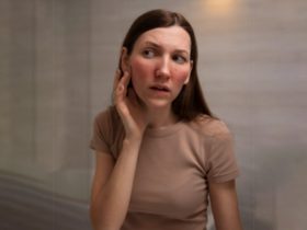 Using Washed Ghee Cream for Sunburn and Heat Rash Relief