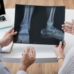 4 Myths About Knee Replacement Surgery That Delay Proper Treatment