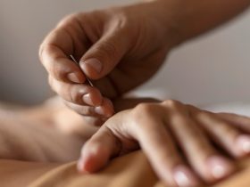 5 Reasons to Seek TCM Acupuncture in Singapore This Year