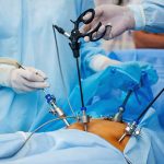 How to Choose the Right HandsOn Laparoscopic Training Program
