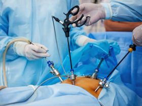 How to Choose the Right HandsOn Laparoscopic Training Program