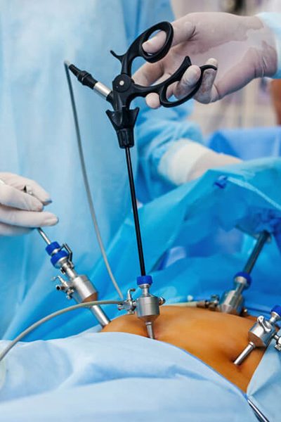 How to Choose the Right HandsOn Laparoscopic Training Program