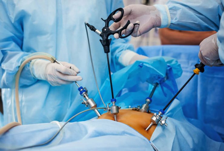 How to Choose the Right HandsOn Laparoscopic Training Program