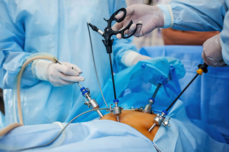 How to Choose the Right HandsOn Laparoscopic Training Program