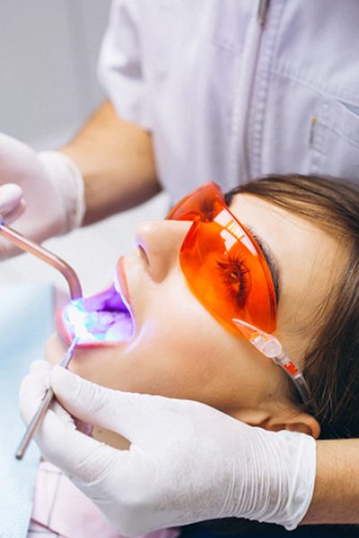 Teeth Whitening Options Explained for Brighter Smiles
