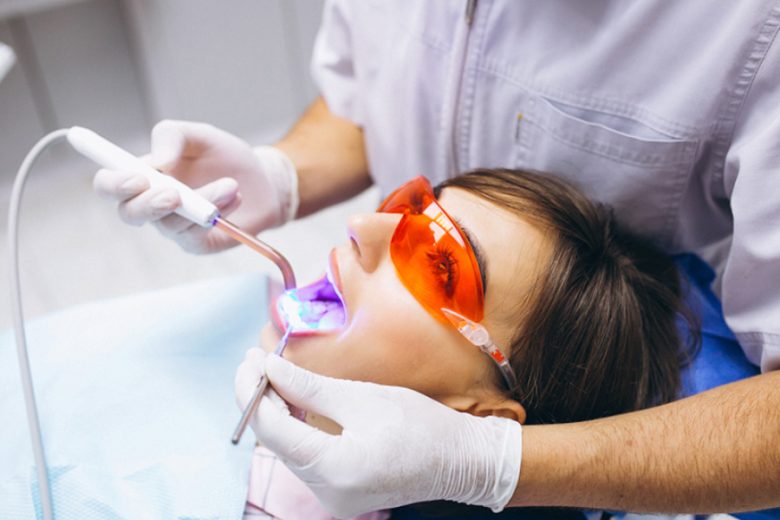 Teeth Whitening Options Explained for Brighter Smiles