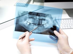 What to Expect During a Root Canal Treatment in Singapore