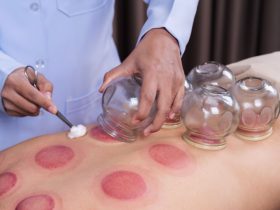 How TCM Slimming Differs From Conventional Dieting Methods in Singapore