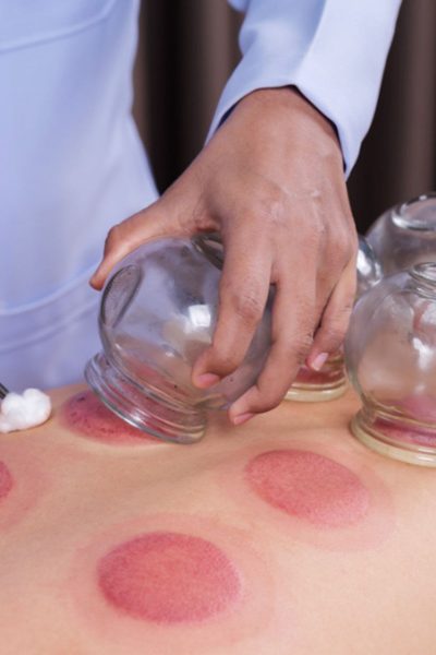 How TCM Slimming Differs From Conventional Dieting Methods in Singapore