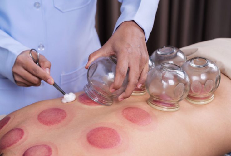 How TCM Slimming Differs From Conventional Dieting Methods in Singapore