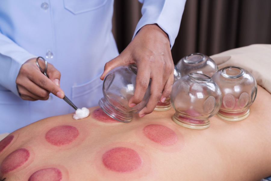 How TCM Slimming Differs From Conventional Dieting Methods in Singapore