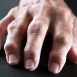 Managing Arthritis Symptoms With Advanced Regenerative Approaches