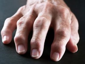 Managing Arthritis Symptoms With Advanced Regenerative Approaches